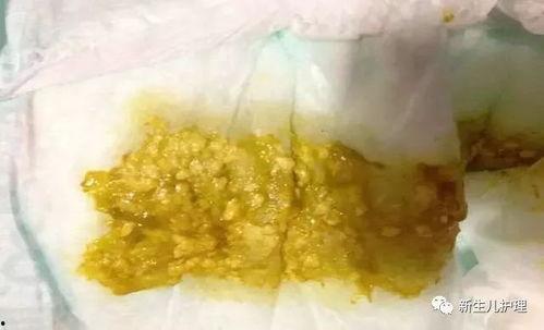 宝宝便秘吃哈密瓜行吗,“哈密瓜助力宝宝缓解便秘困扰”